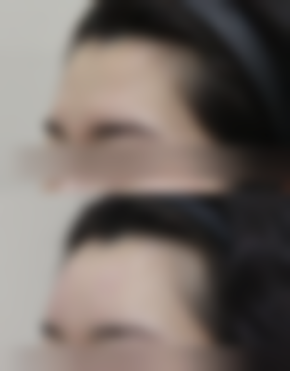 个性化方案优势:精细定制成效好