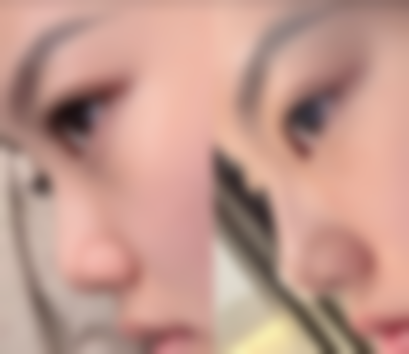 五、焦作陶子医疗美容门诊部实例