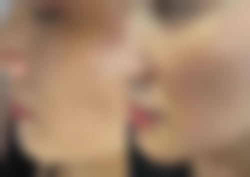 六、西安高新医院整形科怎么预约: