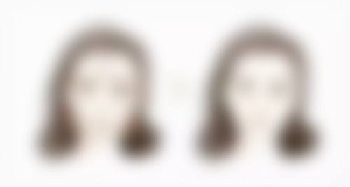 提眉与眼袋手术特殊修复情况是怎样的？