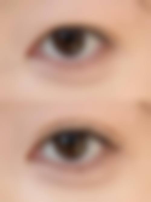 五、银川市第一人民医院(美容整形科)实例