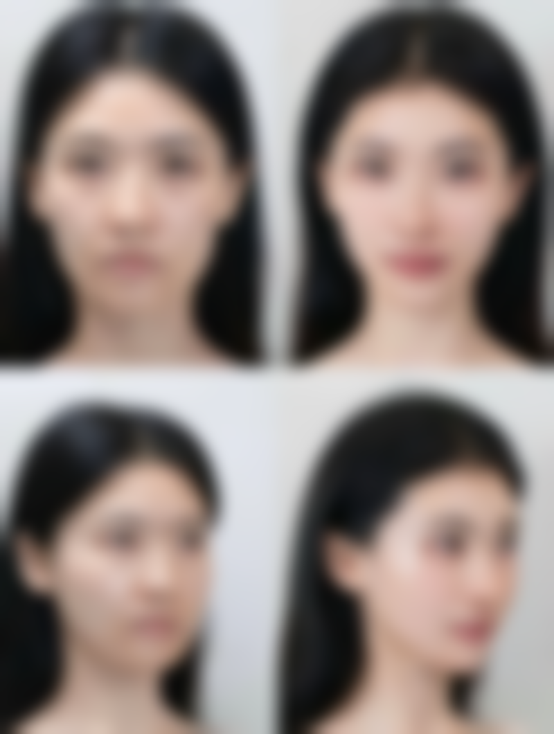 五、烟台瑞雅韩医疗美容诊所实例