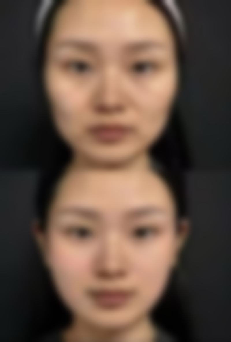 七、西安高新医院整形科价格表:(仅供参考)