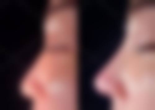 张曼鑫医生口碑和评价