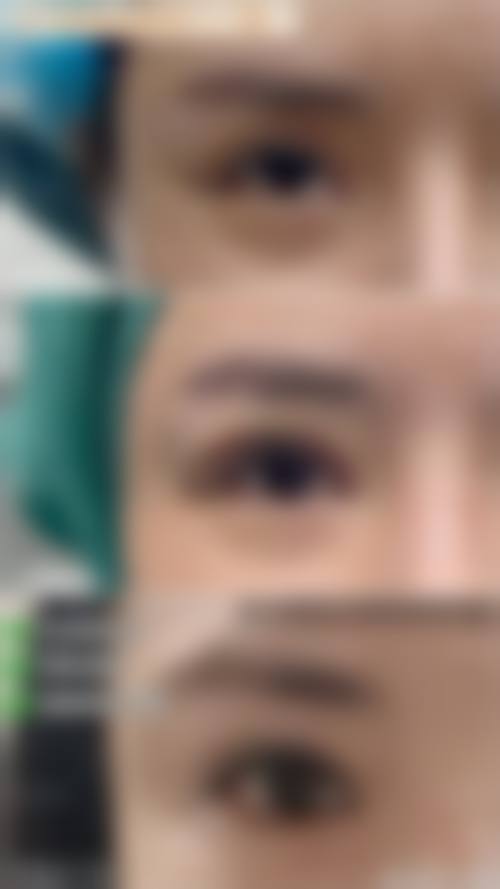 五、郑州何氏医疗美容诊所实例