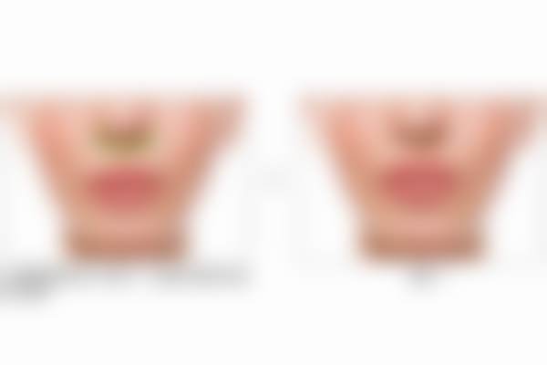 北京蕾士悦容医疗美容门诊部韩国帝医思黄金微针医生团队