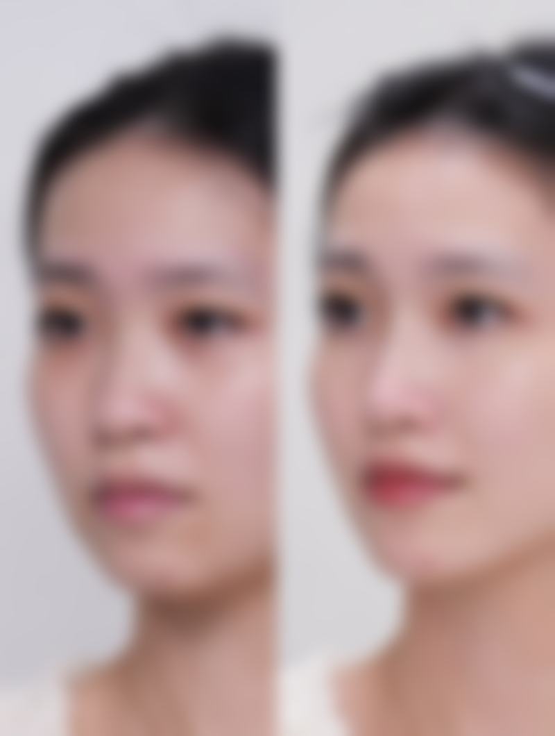 王润之医生实例