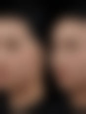 六、郑州何氏医疗美容诊所怎么预约: