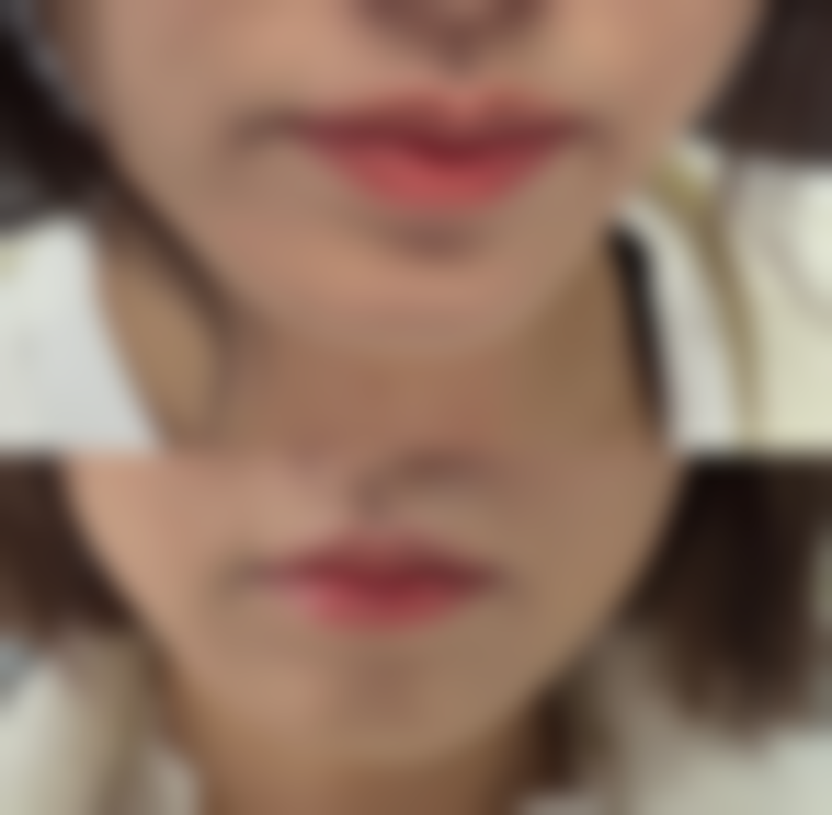 六、长春保丽盛轻颜整形医院价格表：（仅供参考）