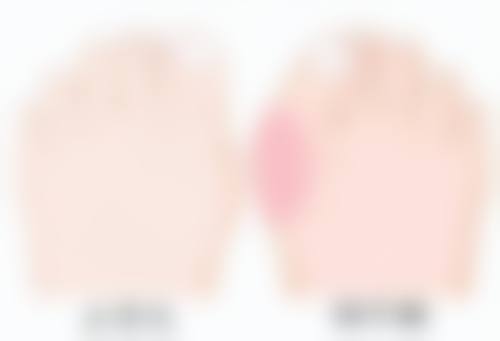 日常护理与注意事项：细心呵护加速淡化