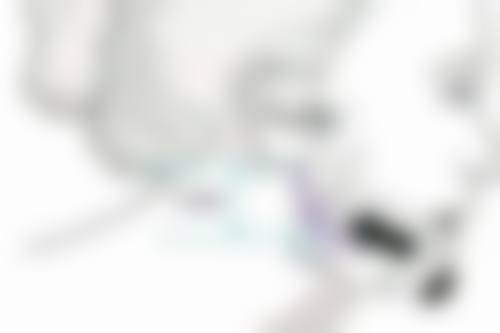 国字脸打瘦脸针究竟有没有效？解析不同成因效果差异及注射前后注意要点 