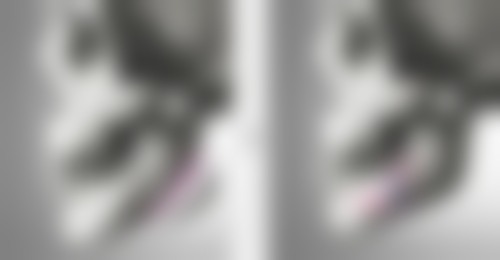 双眼皮增生用疤克：预防成效出色