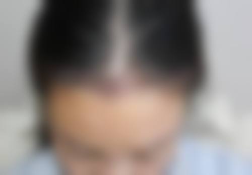 李自克医生在哪家医院