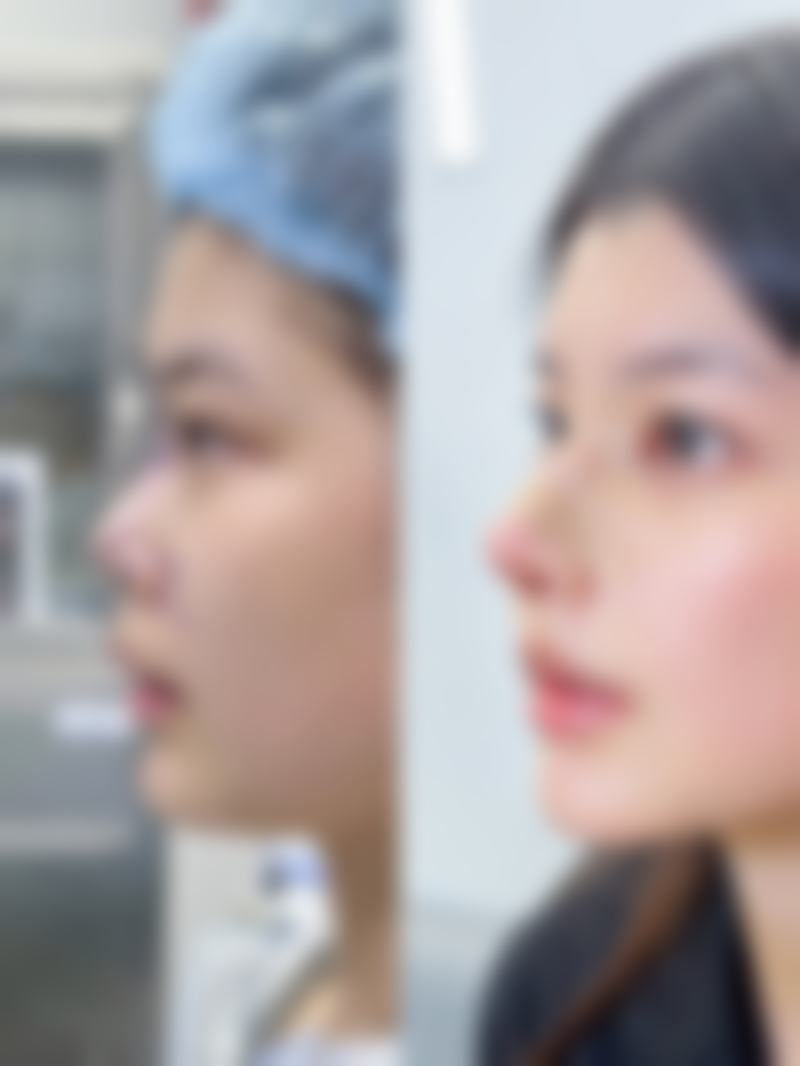 七、杭州东芳妍医疗美容诊所真实的顾客评价如下：