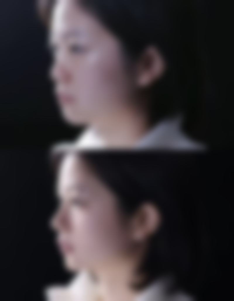 五、杭州马泷远汇整形医院实例