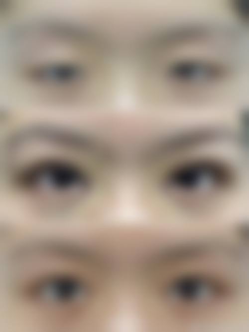 五、泸州欣颜怡美整形医院实例