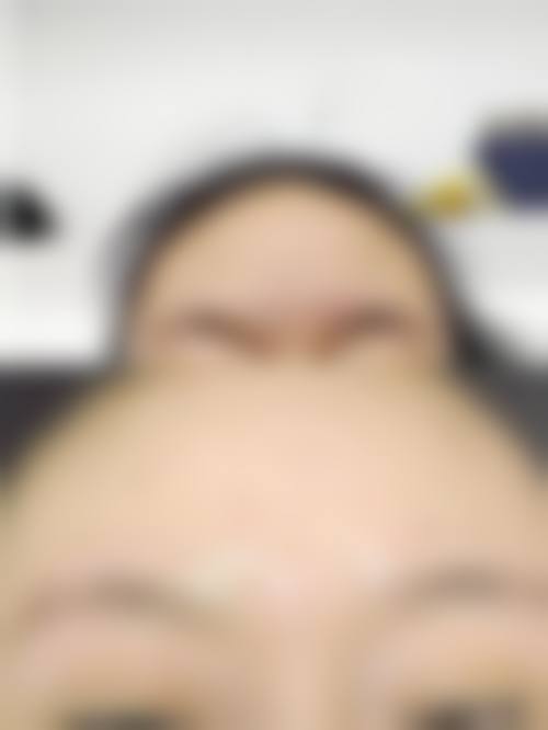 五、白城春俏美容整形医院实例