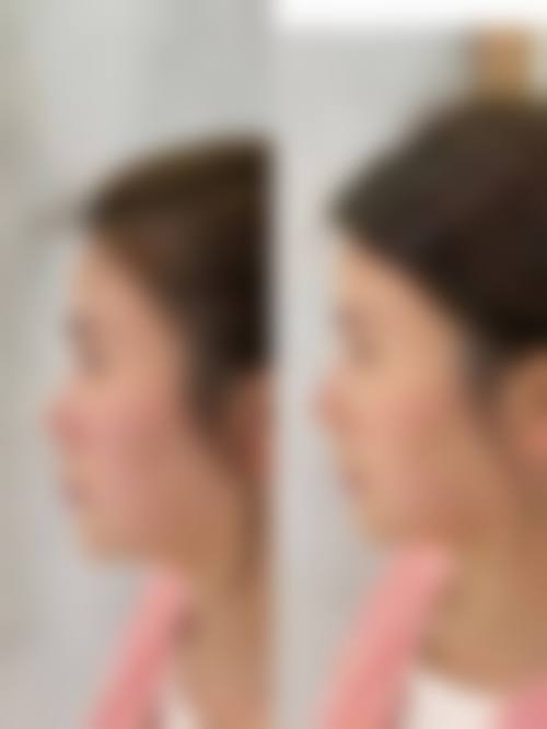 六、韩国aive皮肤科医院怎么预约：