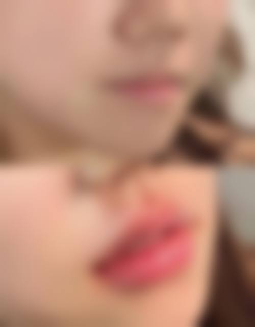 五、韩国ITEM（爱婷）整形医院实例