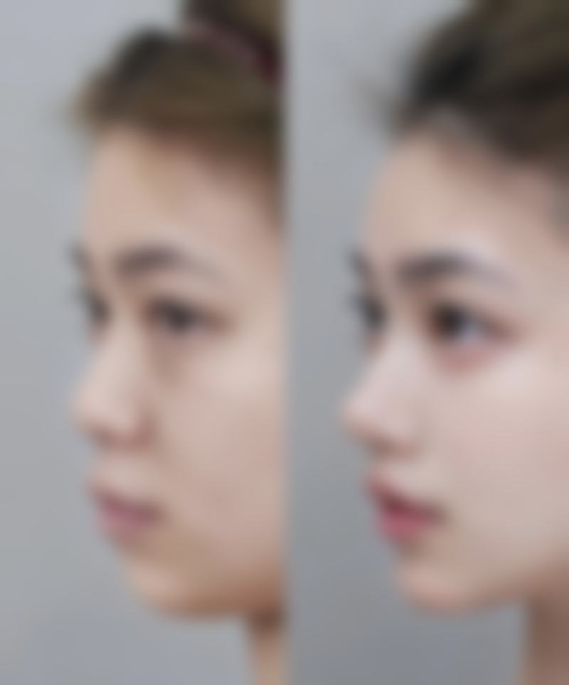 八、白城春俏美容整形医院真实的顾客评价如下：