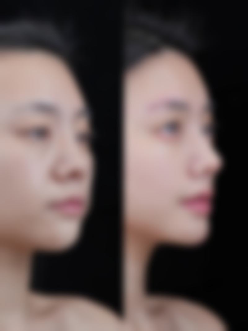 三、韩国ITEM（爱婷）整形医院医生介绍: