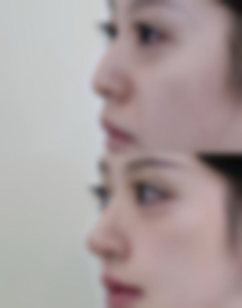 八、韩国ITEM（爱婷）整形医院真实的顾客评价如下：