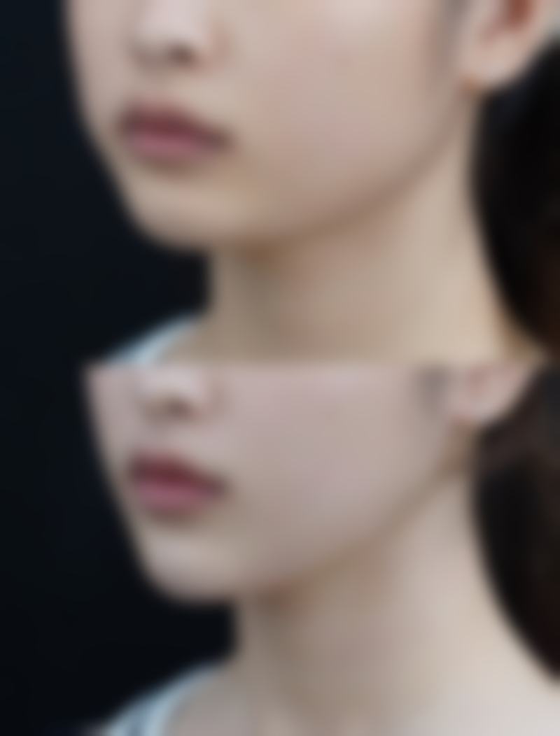 八、泸州欣颜怡美整形医院真实的顾客评价如下: