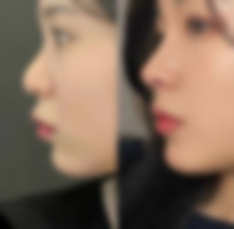 五、大连李耀宇整形医疗美容诊所实例