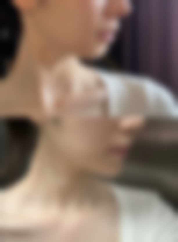 半肋骨隆鼻子成效能否恒久？手术操作和术后护理特别重要