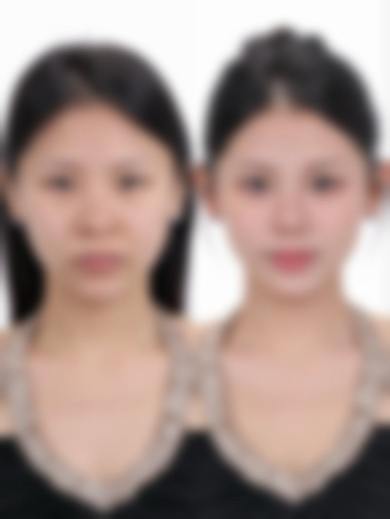 卢燕云医生怎么样可靠吗？