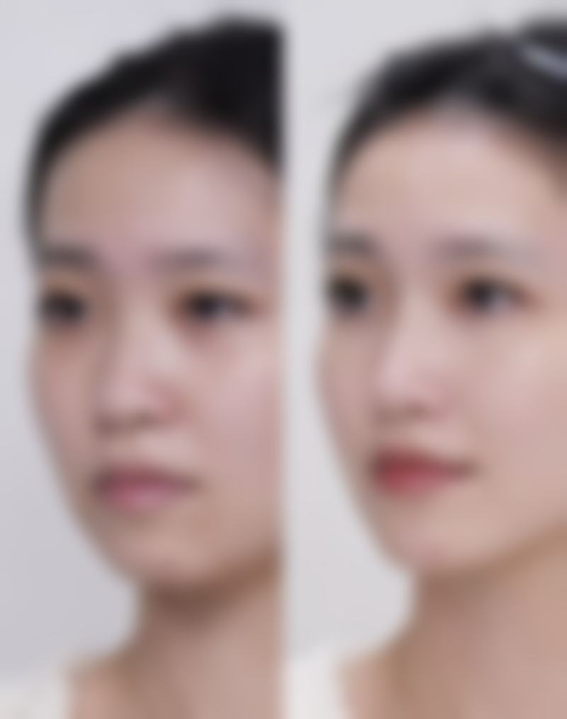 八、韩国车李郑整形外科医院真实的顾客评价如下：