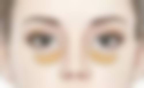 如何快速去除重度黑眼圈眼袋？天然食材与按摩手法结合的优势