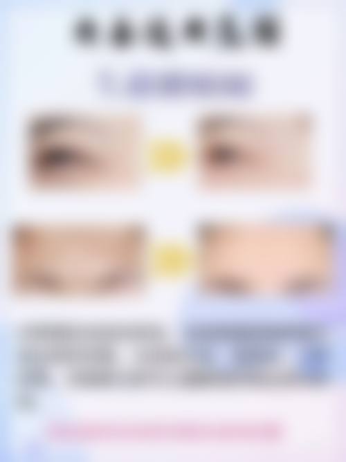 揭秘包膜吸收时间差异