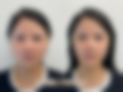 八、成都天渡整形医院真实的顾客评价如下: