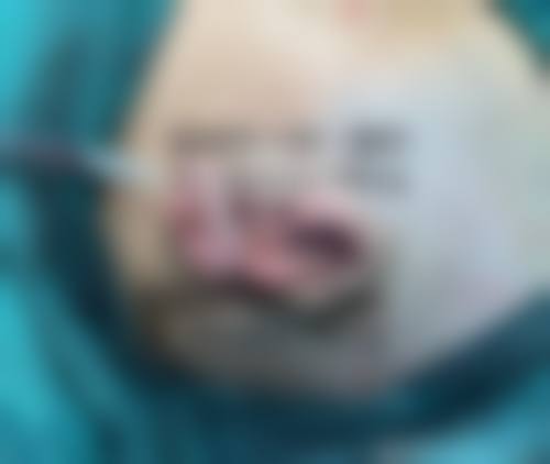 七、山东大学齐鲁医院德州医院医学整形美容科价格表:(仅供参考)