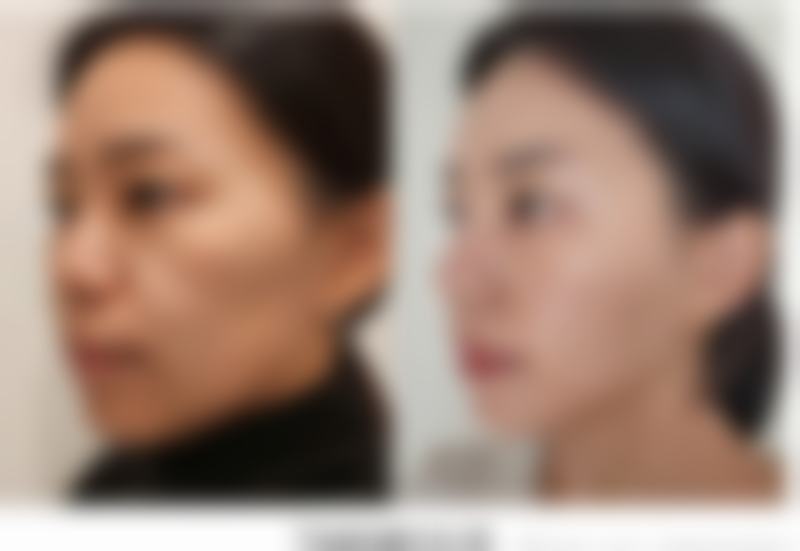 六、佛山美瑟琳医疗美容门诊部价格表：（仅供参考）