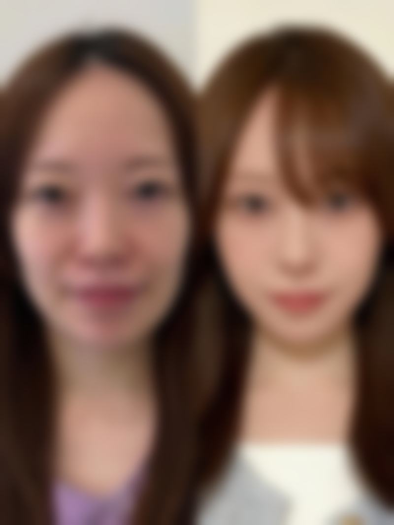 隆鼻修复包膜会吸收吗？揭秘吸收时间差异，了解包膜吸收对鼻子高度的微妙影响