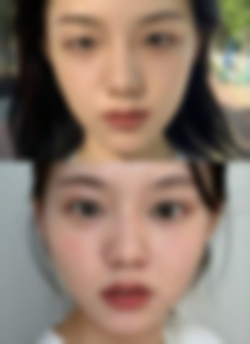 七、龙岩语卿整形医院价格表：（仅供参考）