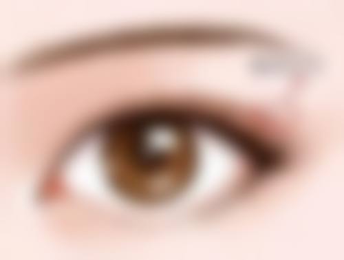 注射胶原蛋白隆鼻成效怎样？创伤小修复快不是梦