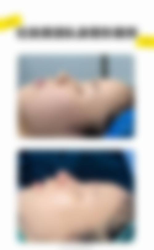 四、天津市眼科医院（医疗美容科）实例