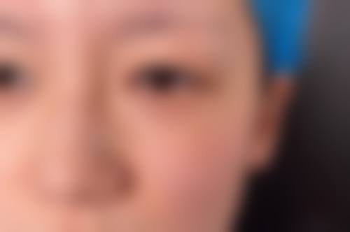 六、郑州娇点医疗美容诊所价格表：（仅供参考）