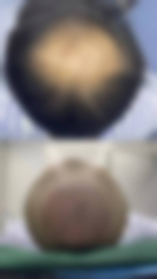 余群洪医生口碑和评价