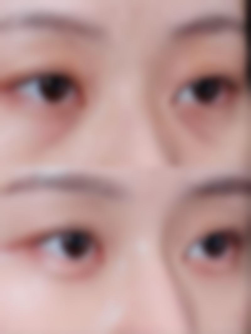 王晓亚医生怎么样可靠吗？