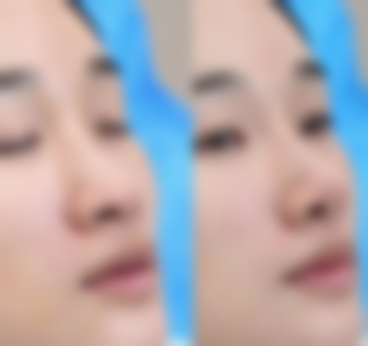 王晓亚医生在哪家医院