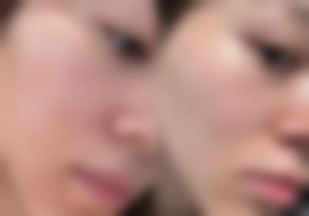 陆洁医生项目价格表参考