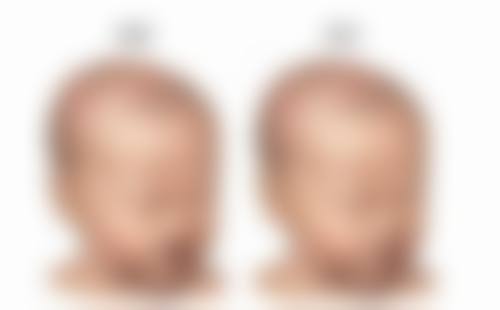 张小丽医生怎么样可靠吗？