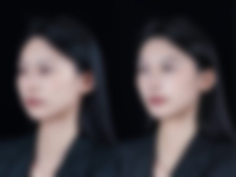 五、NJH卢钟勋整形外科医院实例