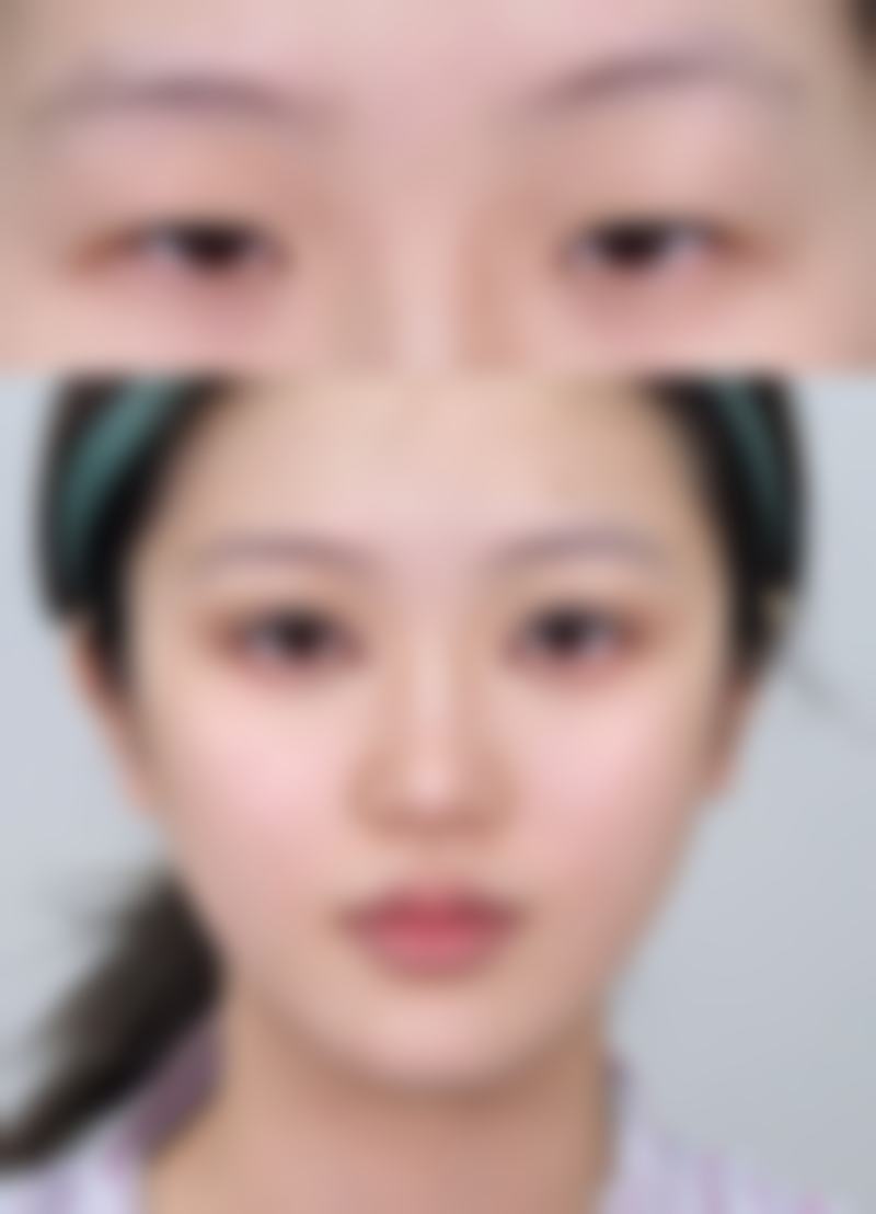 六、北京瀛美医疗美容医院怎么预约：