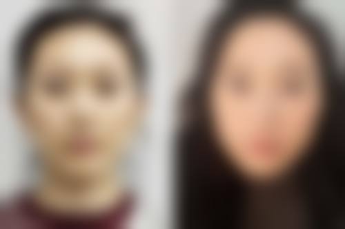 五、青海西宁红十字医院整形美容科实例