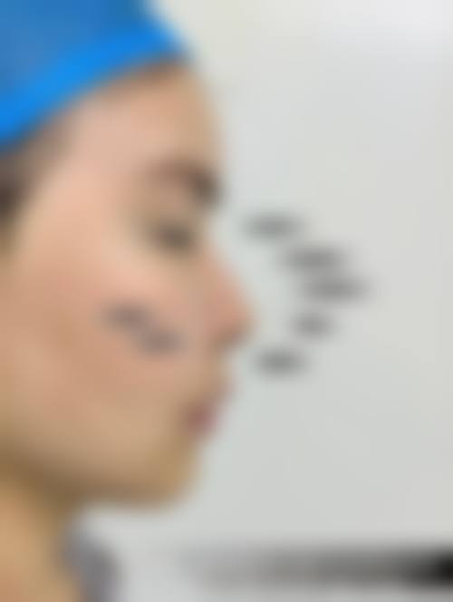 五、韩国A特整形外科医院实例